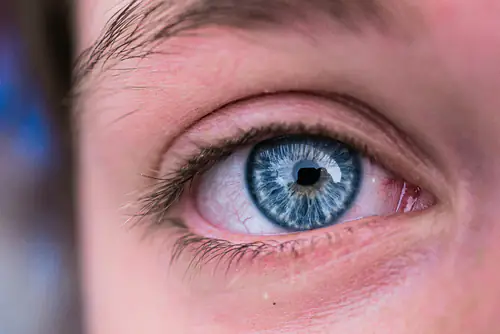 Tem sentido os seus <strong>olhos secos?</strong>